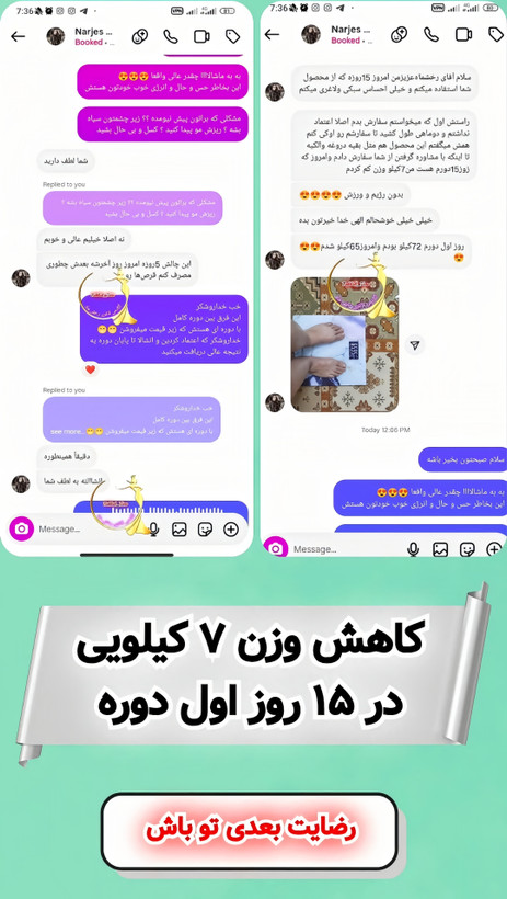 دوره لاغری قرص ( gastric balloon ) کاهش وزن ۱۸ تا ۲۲ کیلو در ۹۰ روز